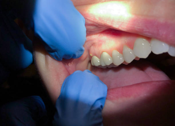 Best Dentist for Dental Trauma  in Belford, NJ