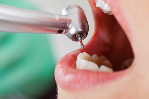Best Root Canal Emergency Dentist  in Belford, NJ